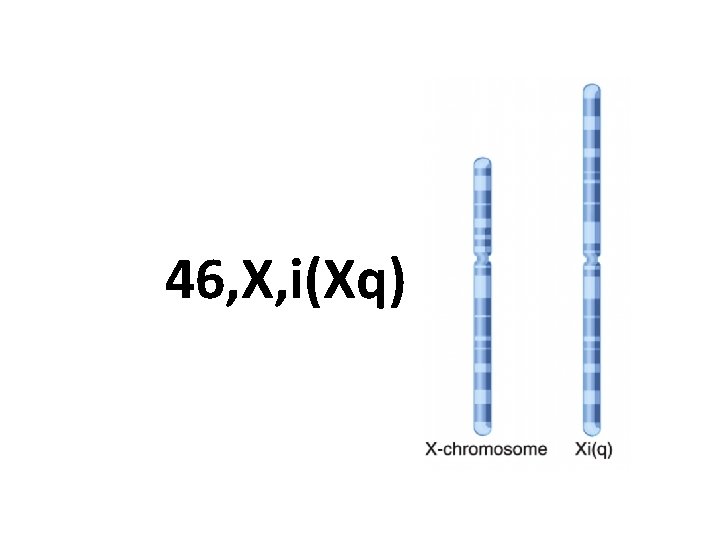 46, X, i(Xq) 