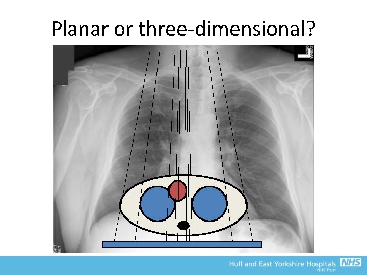 Planar or three-dimensional? 