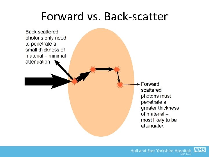 Forward vs. Back-scatter 