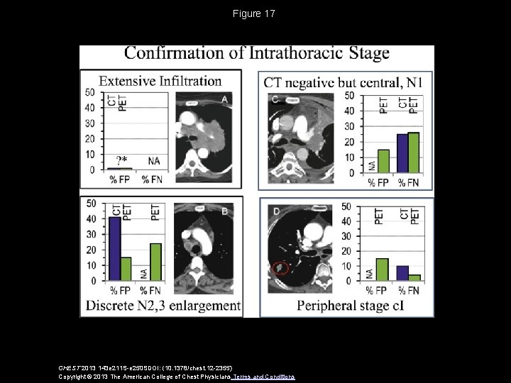 Figure 17 CHEST 2013 143 e 211 S-e 250 SDOI: (10. 1378/chest. 12 -2355)