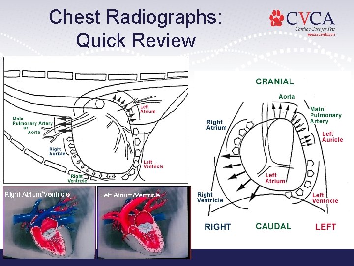 Chest Radiographs: Quick Review 