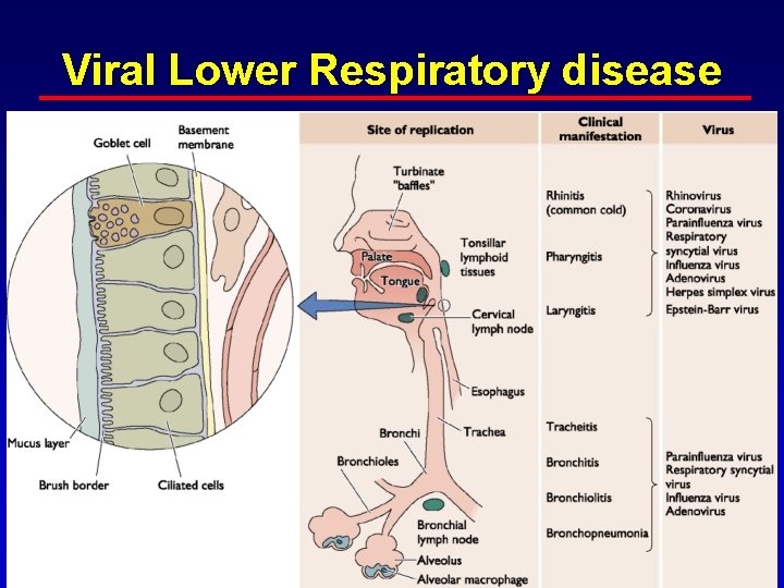 Viral Lower Respiratory disease 