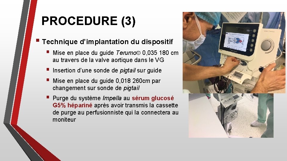 PROCEDURE (3) § Technique d’implantation du dispositif § Mise en place du guide Terumo©