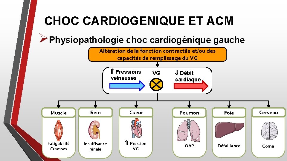 CHOC CARDIOGENIQUE ET ACM ØPhysiopathologie choc cardiogénique gauche Altération de la fonction contractile et/ou