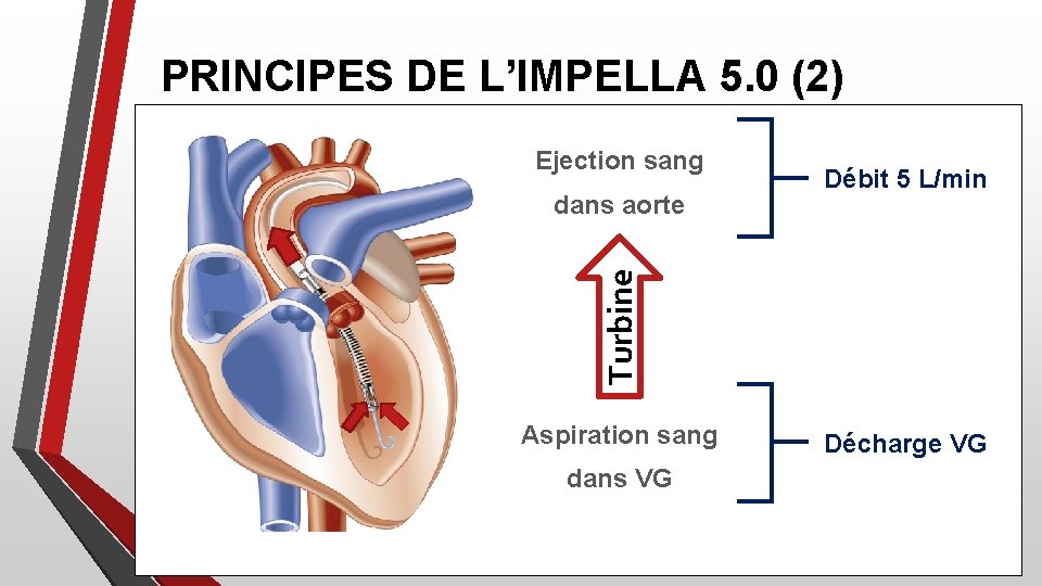 PRINCIPES DE L’IMPELLA 5. 0 (2) Ejection sang Turbine dans aorte Débit 5 L/min