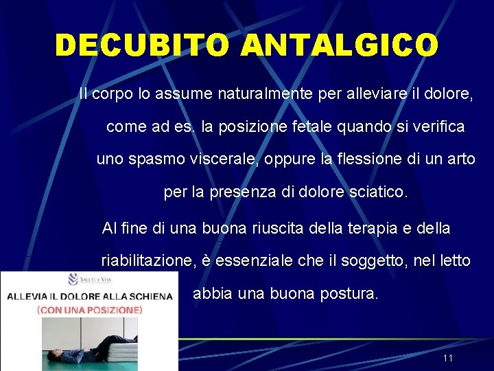 DECUBITO ANTALGICO Il corpo lo assume naturalmente per alleviare il dolore, come ad es. DECUBITO ANTALGICO Il corpo lo assume naturalmente per alleviare il dolore, come ad es.