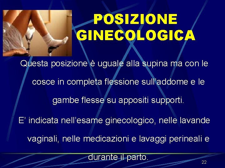 POSIZIONE GINECOLOGICA Questa posizione è uguale alla supina ma con le cosce in completa POSIZIONE GINECOLOGICA Questa posizione è uguale alla supina ma con le cosce in completa