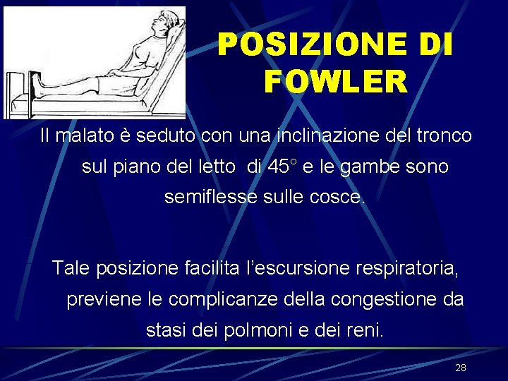 POSIZIONE DI FOWLER Il malato è seduto con una inclinazione del tronco sul piano POSIZIONE DI FOWLER Il malato è seduto con una inclinazione del tronco sul piano
