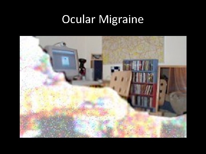 Ocular Migraine 