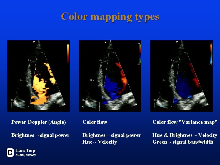 Color mapping types Power Doppler (Angio) Color flow ”Variance map” Brightnes ~ signal power