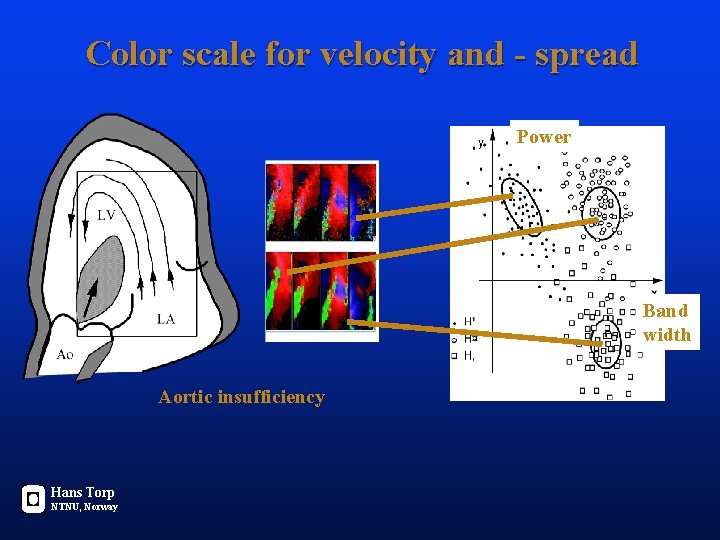 Color scale for velocity and - spread Power Band width Aortic insufficiency Hans Torp