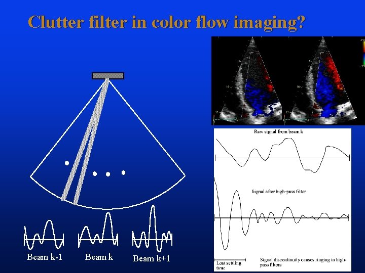 Clutter filter in color flow imaging? Beam k-1 Beam k+1 