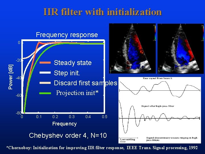 IIR filter with initialization Frequency response 0 Power [d. B] -20 Steady state Step