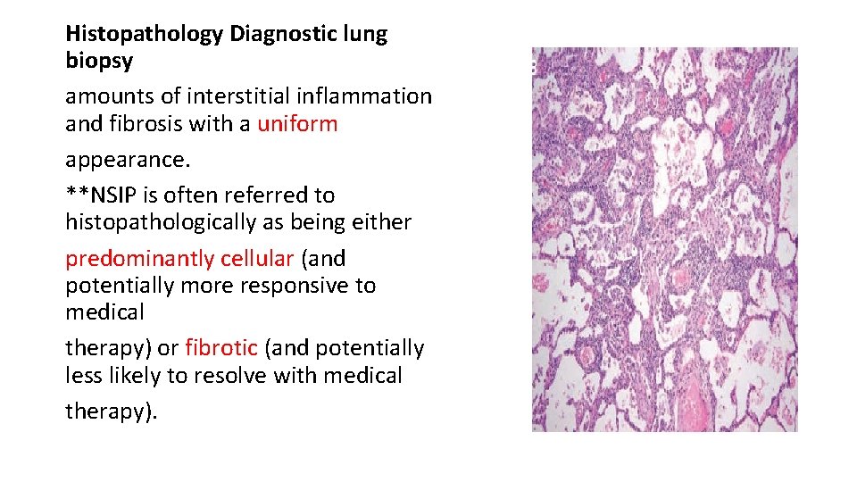 Histopathology Diagnostic lung biopsy amounts of interstitial inflammation and fibrosis with a uniform appearance.