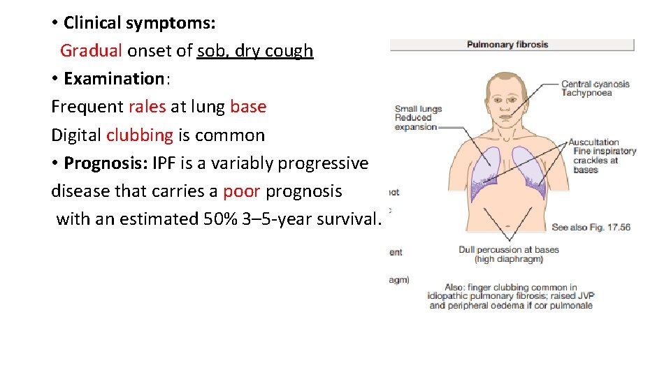 incidence of malignant mesothelioma