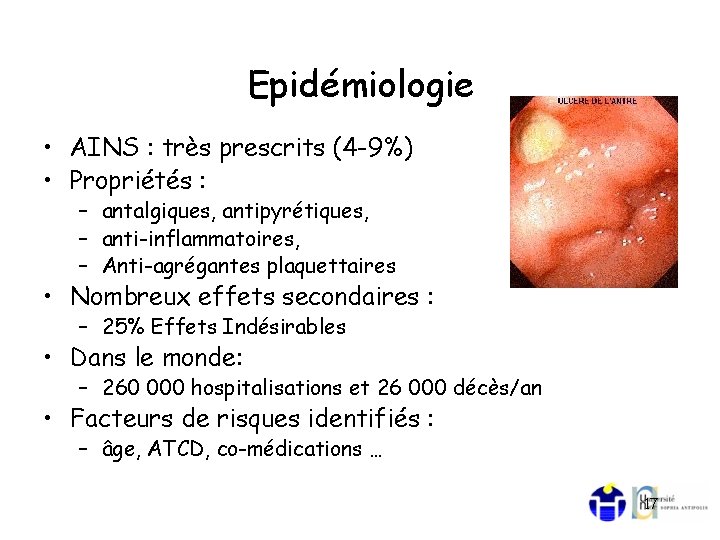 Epidémiologie • AINS : très prescrits (4 -9%) • Propriétés : – antalgiques, antipyrétiques,