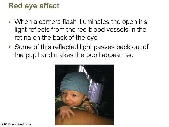 Red eye effect • When a camera flash illuminates the open iris, light reflects