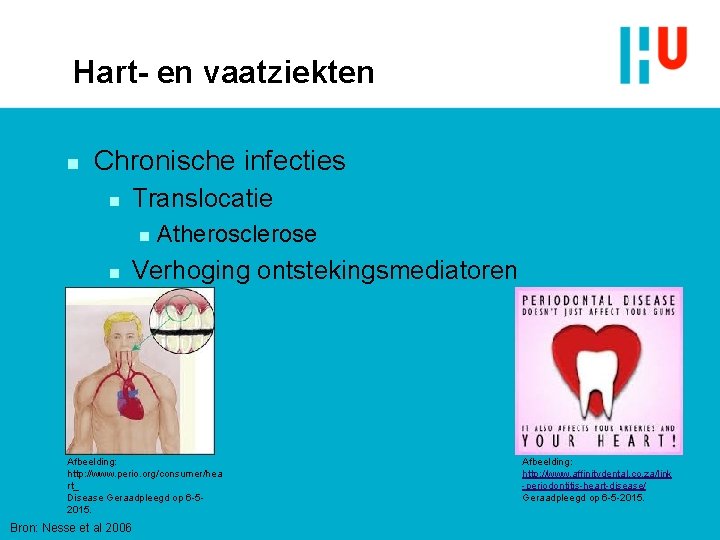 Hart- en vaatziekten n Chronische infecties n Translocatie n n Atherosclerose Verhoging ontstekingsmediatoren Afbeelding: