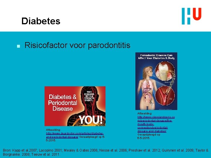 Diabetes n Risicofactor voor parodontitis Afbeelding: http: //www. deardoctor. com/articles/diabetesand-periodontal-disease/ Geraadpleegd op 65 -2015.