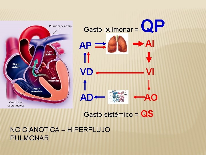 Gasto pulmonar = QP AP AI VD VI AD AO Gasto sistémico = QS