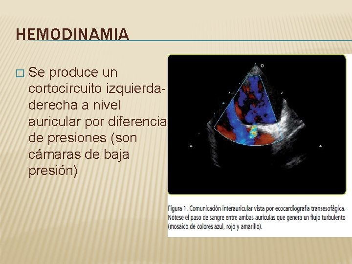 HEMODINAMIA � Se produce un cortocircuito izquierdaderecha a nivel auricular por diferencia de presiones