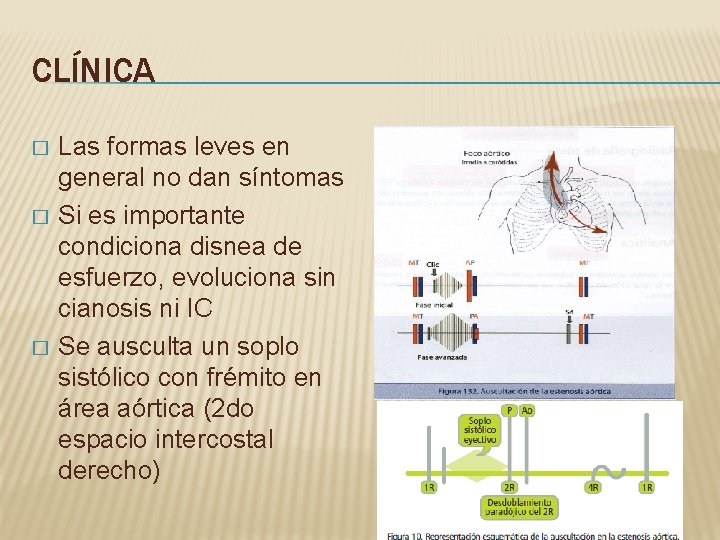 CLÍNICA � � � Las formas leves en general no dan síntomas Si es