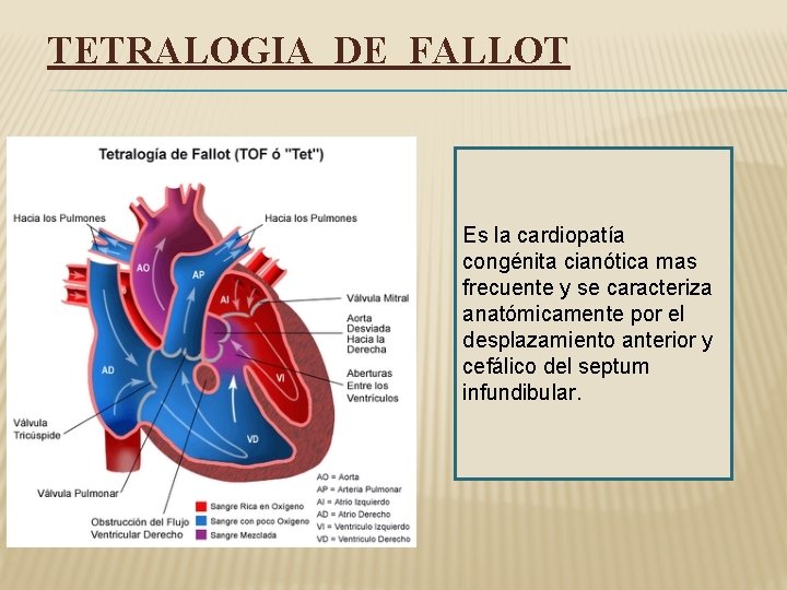 TETRALOGIA DE FALLOT Es la cardiopatía congénita cianótica mas frecuente y se caracteriza anatómicamente