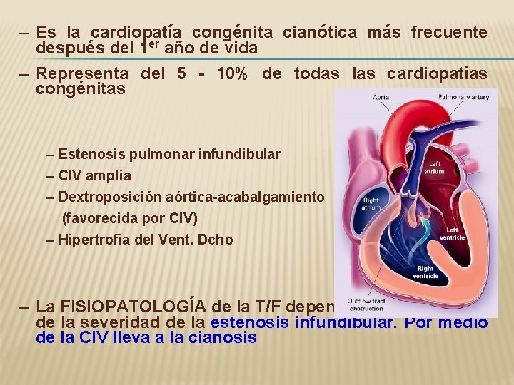 – Es la cardiopatía congénita cianótica más frecuente después del 1 er año de