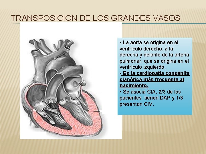 TRANSPOSICION DE LOS GRANDES VASOS • La aorta se origina en el ventrículo derecho,