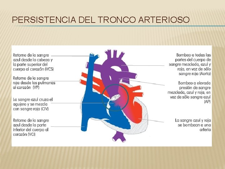 PERSISTENCIA DEL TRONCO ARTERIOSO 