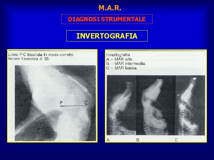 M. A. R. DIAGNOSI STRUMENTALE INVERTOGRAFIA 