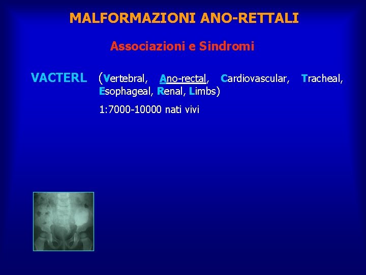 MALFORMAZIONI ANO-RETTALI Associazioni e Sindromi VACTERL (Vertebral, Ano-rectal, Cardiovascular, Tracheal, Esophageal, Renal, Limbs) 1: