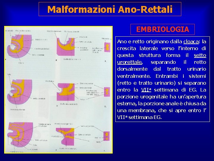 Malformazioni Ano-Rettali EMBRIOLOGIA Ano e retto originano dalla cloaca: la crescita laterale verso l’interno