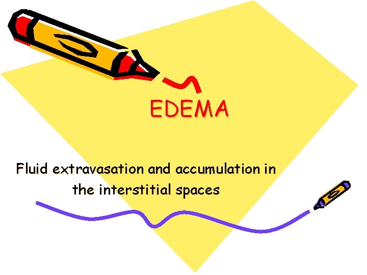 EDEMA Fluid extravasation and accumulation in the interstitial spaces 