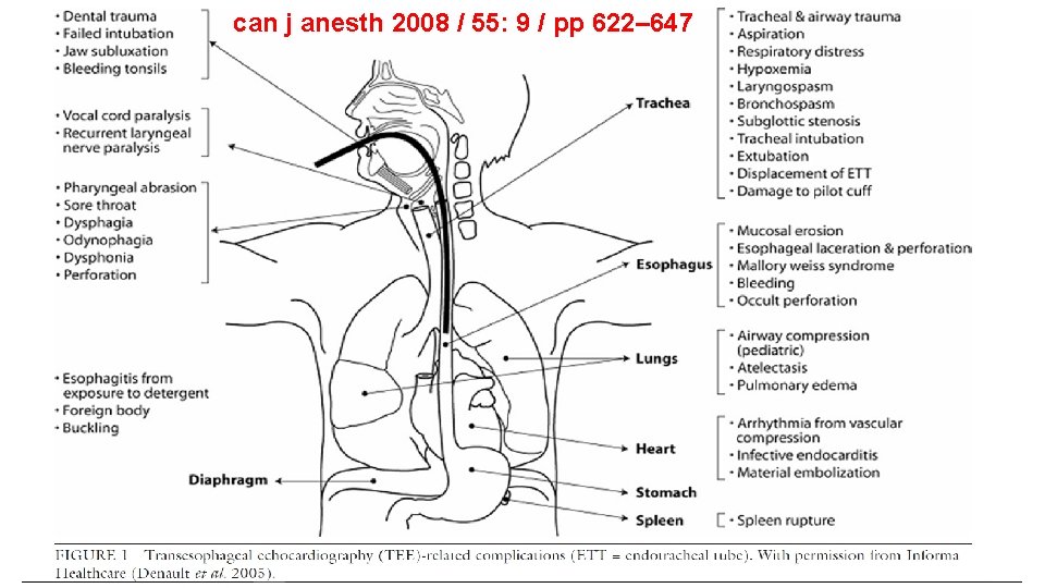 can j anesth 2008 / 55: 9 / pp 622– 647 