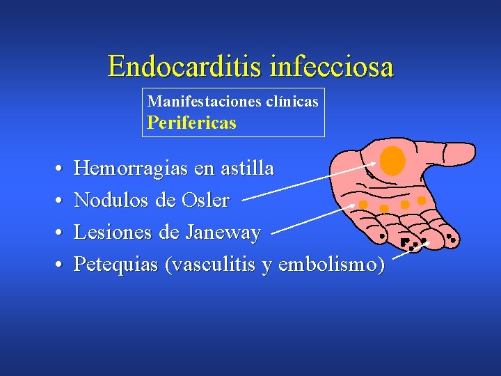 Endocarditis infecciosa Manifestaciones clínicas Perifericas • • Hemorragias en astilla Nodulos de Osler Lesiones
