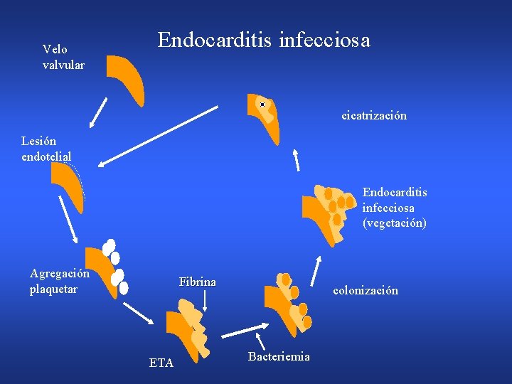 Velo valvular Endocarditis infecciosa cicatrización Lesión endotelial Endocarditis infecciosa (vegetación) Agregación plaquetar Fibrina ETA