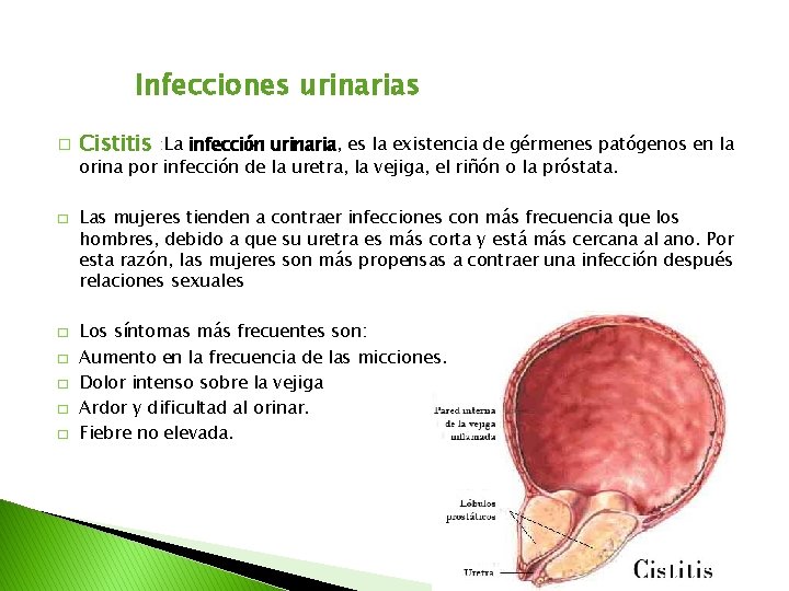 Infecciones urinarias � Cistitis : La infección urinaria, es la existencia de gérmenes patógenos