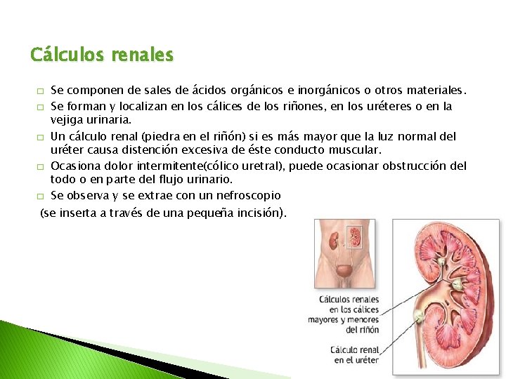 Cálculos renales � � � Se componen de sales de ácidos orgánicos e inorgánicos