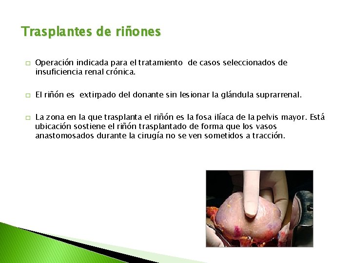 Trasplantes de riñones � � � Operación indicada para el tratamiento de casos seleccionados
