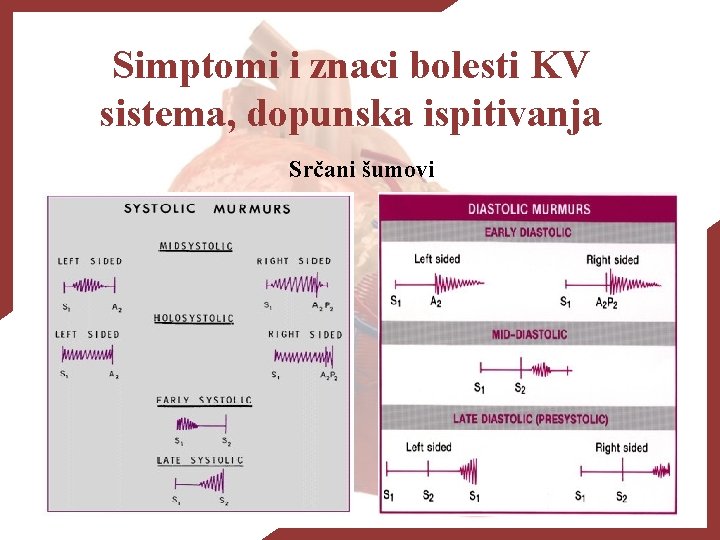 srčani murmurs u hipertenzije