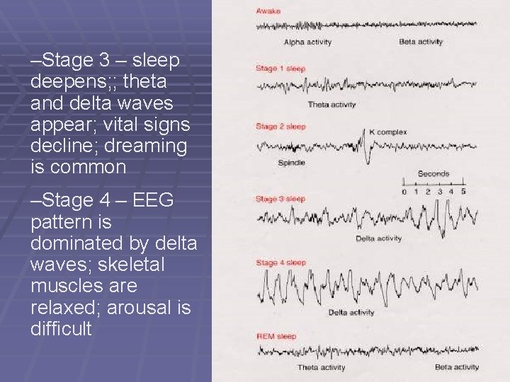 –Stage 3 – sleep deepens; ; theta and delta waves appear; vital signs decline;