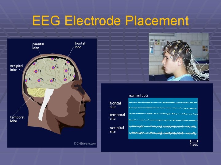 EEG Electrode Placement 