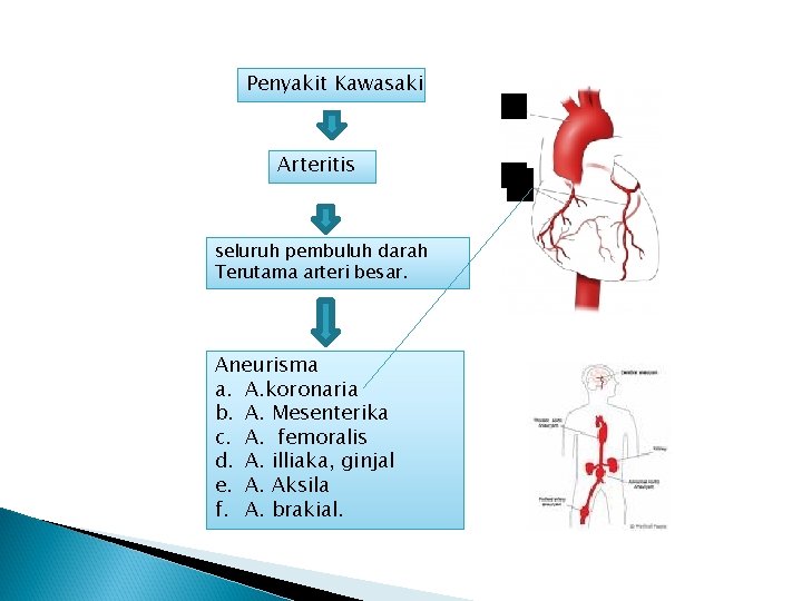 Penyakit Kawasaki Arteritis seluruh pembuluh darah Terutama arteri besar. Aneurisma a. A. koronaria b.