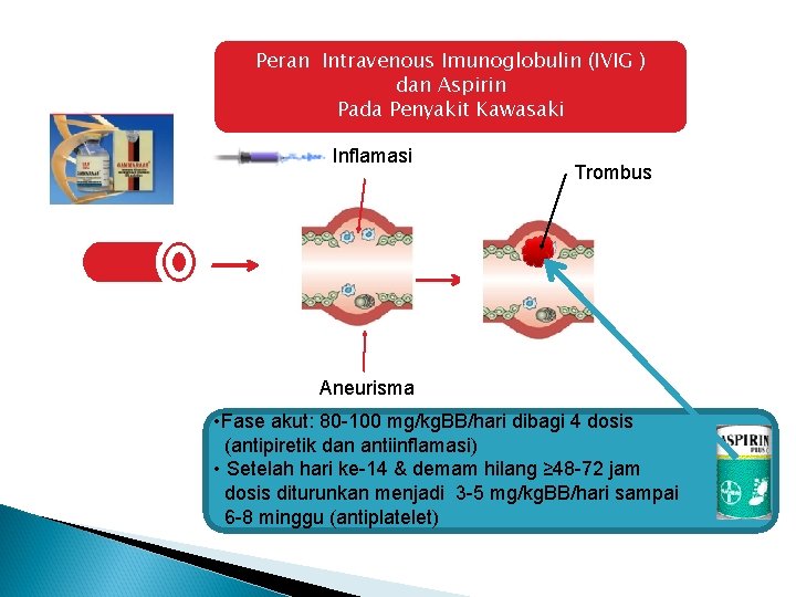 Peran Intravenous Imunoglobulin (IVIG ) dan Aspirin Pada Penyakit Kawasaki Inflamasi Trombus Aneurisma • Peran Intravenous Imunoglobulin (IVIG ) dan Aspirin Pada Penyakit Kawasaki Inflamasi Trombus Aneurisma •