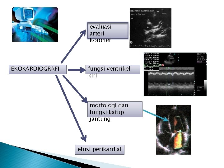 evaluasi arteri koroner EKOKARDIOGRAFI fungsi ventrikel kiri morfologi dan fungsi katup jantung efusi perikardial