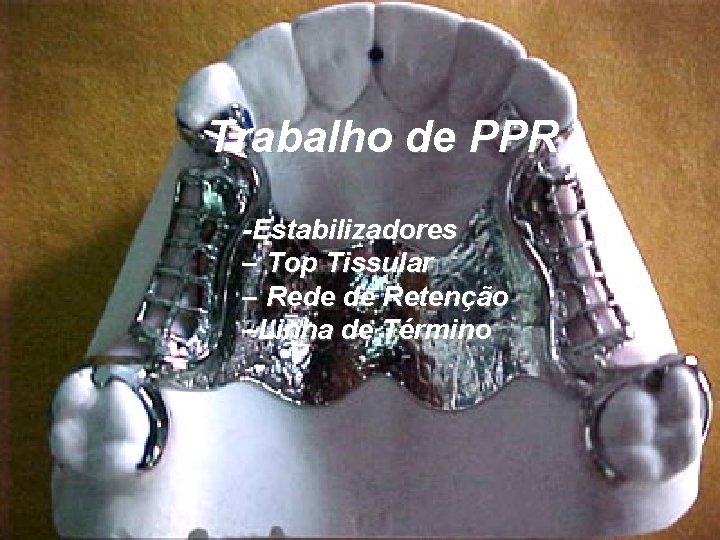 Trabalho de PPR -Estabilizadores – Top Tissular – Rede de Retenção –Linha de Término