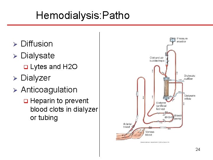 Hemodialysis: Patho Ø Ø Diffusion Dialysate q Ø Ø Lytes and H 2 O