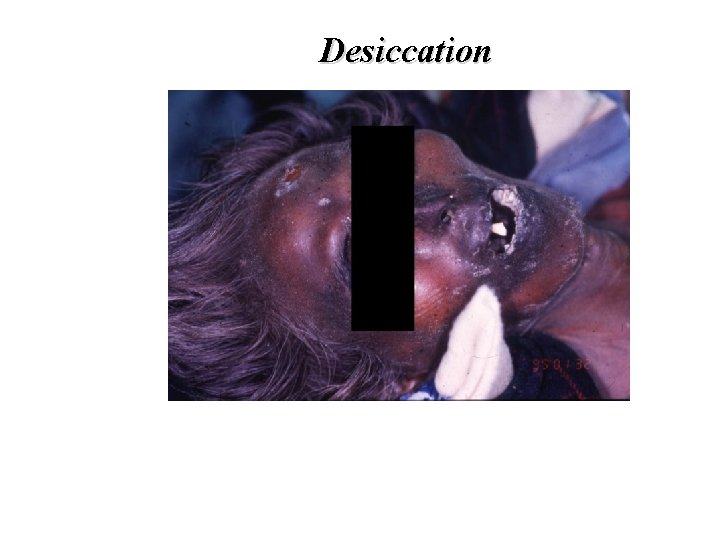Desiccation Desiccation