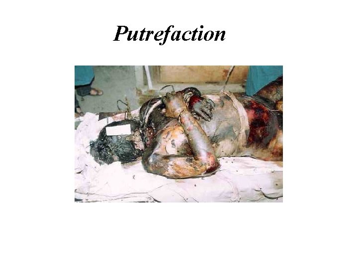 Putrefaction Putrefaction